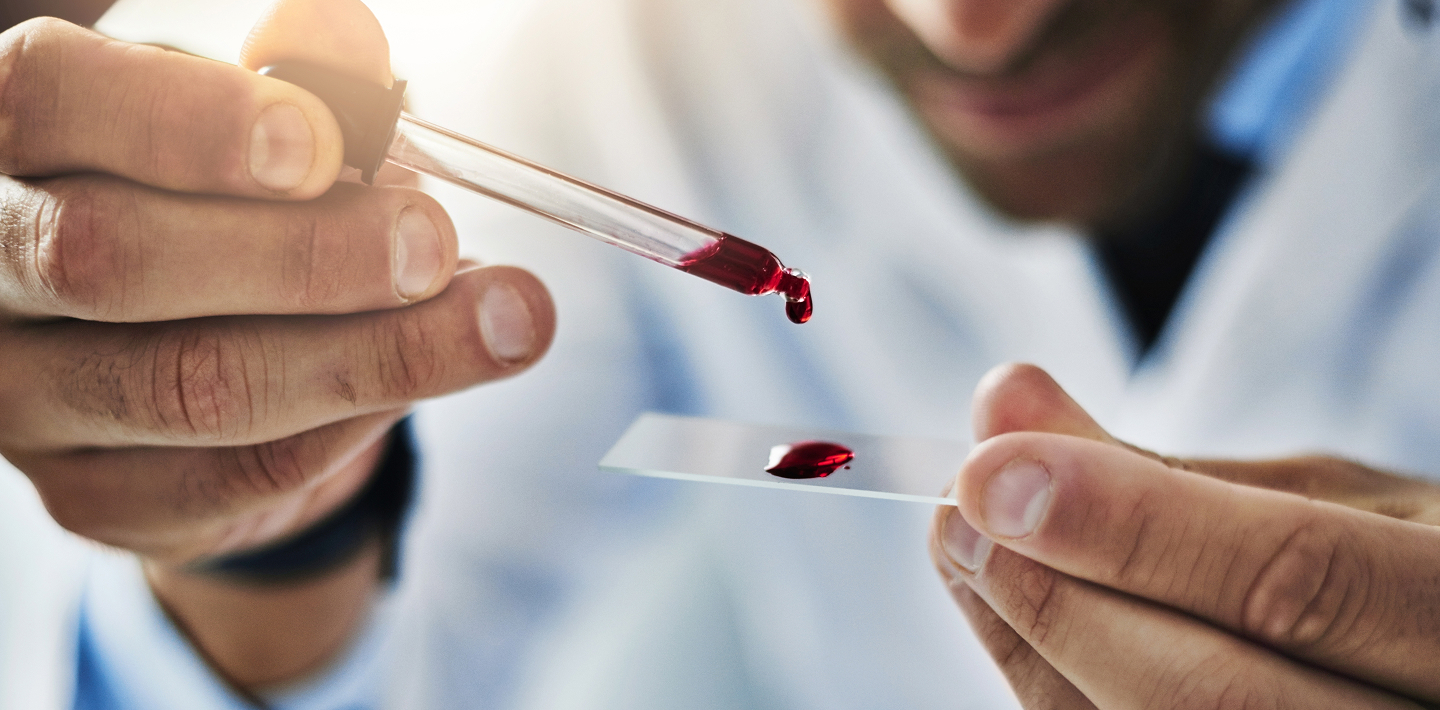 Pricing and Market Access Strategy for a Haematology Product in the GCC