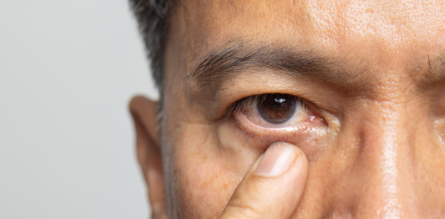 Understanding the Types of Information Used by Physicians when Learning about and Prescribing New Treatments for Thyroid Eye Disease