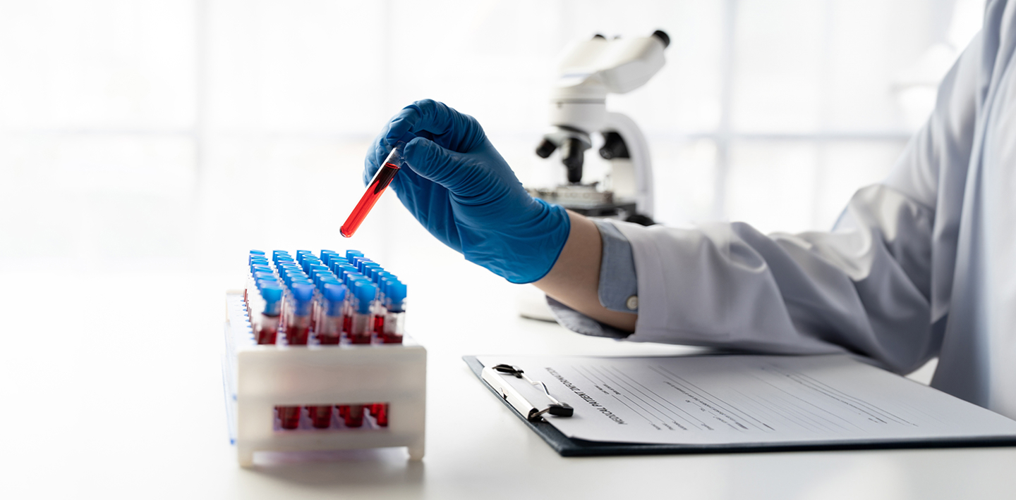 Navigating the market landscape for advanced molecular diagnostics in AMR Management